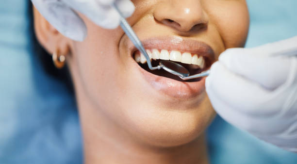 Best Broken or Cracked Tooth Emergency Dentist in Lake Sarasota, FL