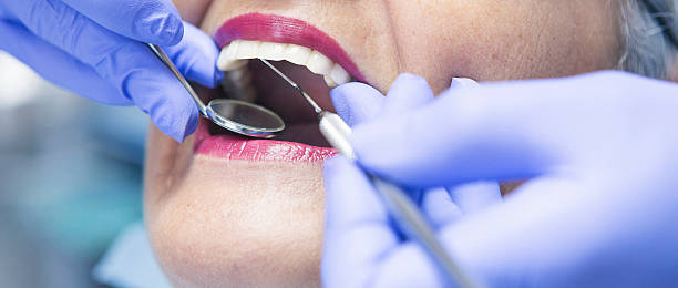 Best Emergency Cosmetic Dentistry in Lake Sarasota, FL